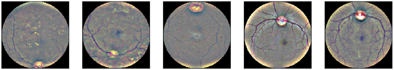 Retina photos