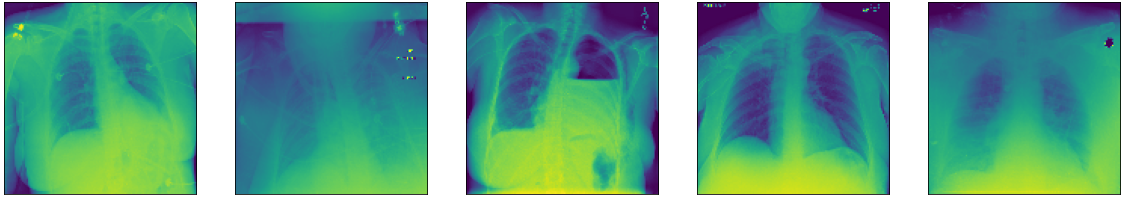 Chest x-ray samples